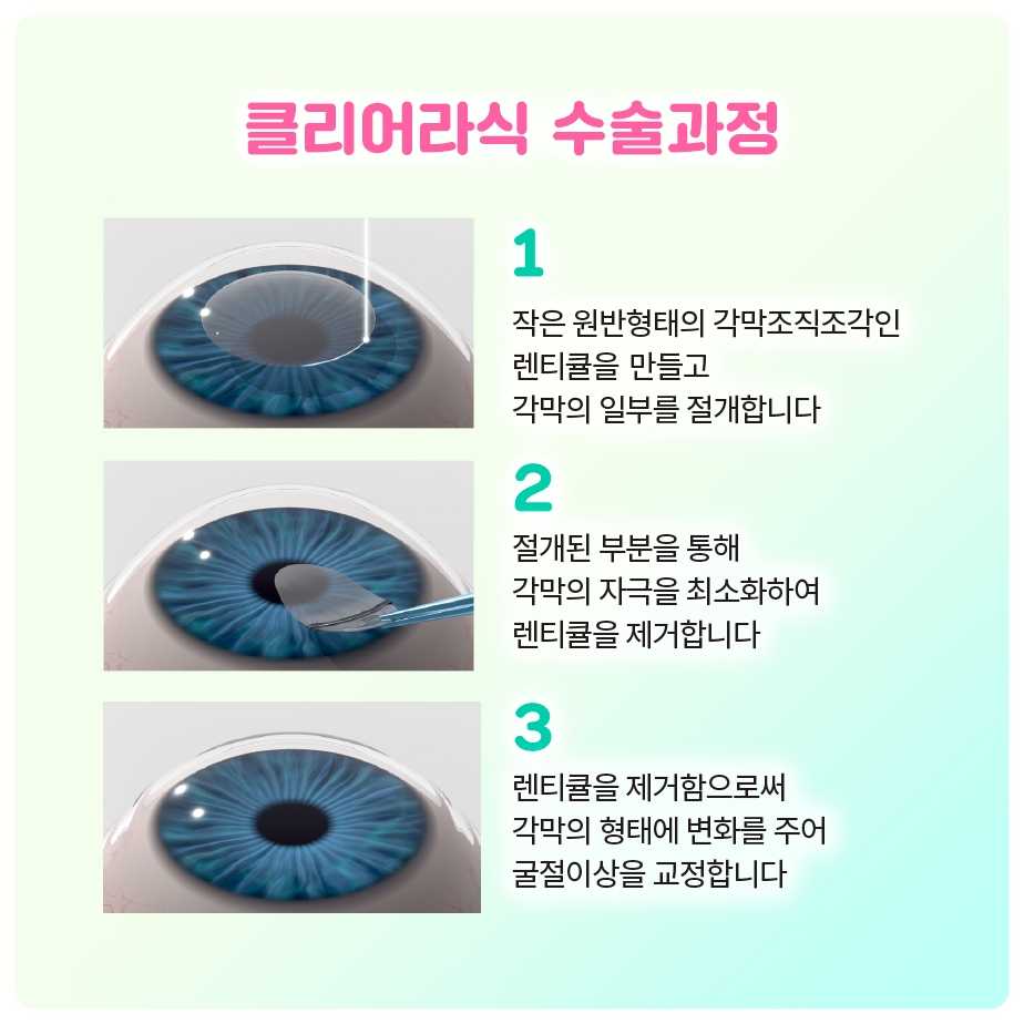 영유아 코눈물관막힘, 여의도소아안과가 안내하는 마사지법과 방문 시기