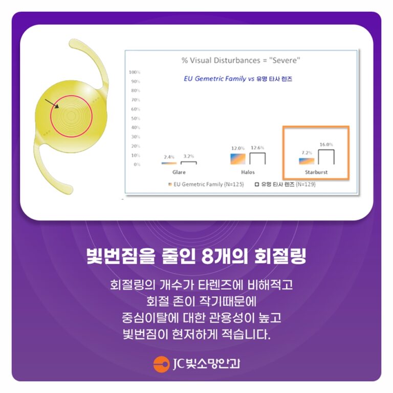 노안교정렌즈와 다초점 인공수정체, 노안백내장 두 방법의 차이