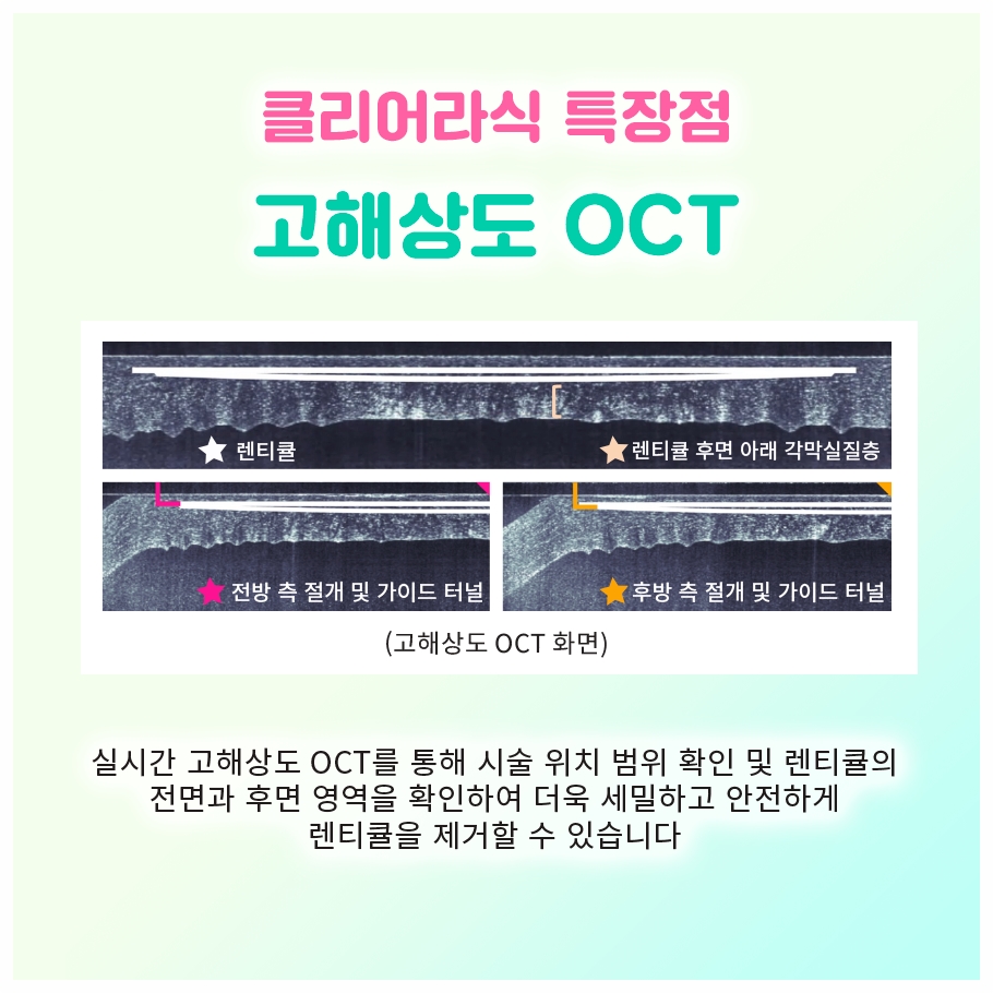 우리 아이 약시, 여의도소아안과가 말하는 만 7세 전 가림치료 이유