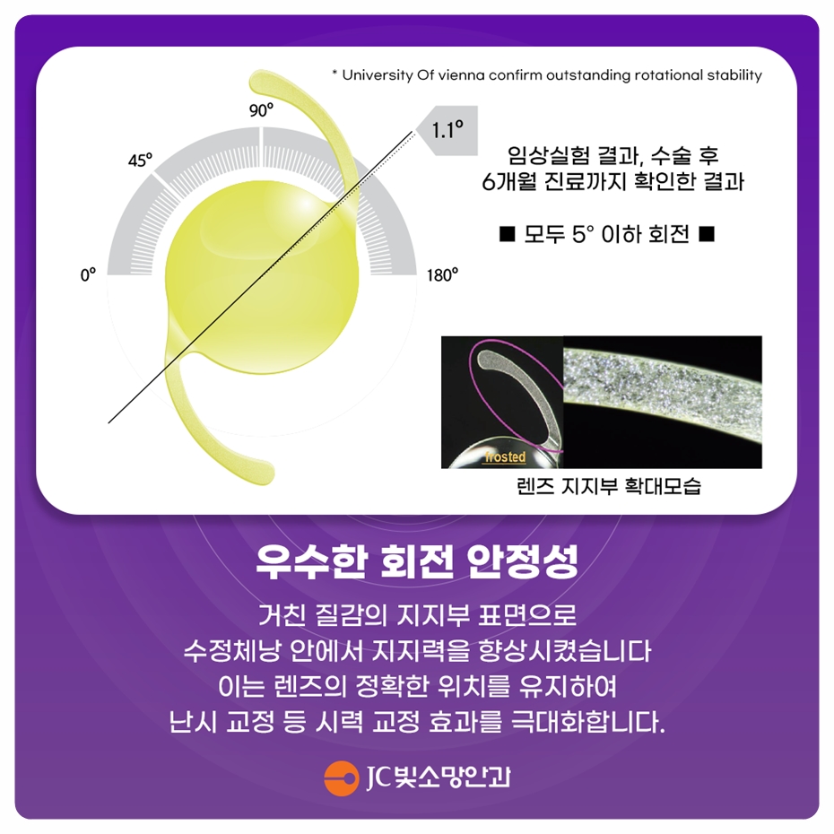 초고도근시인데 백내장 수술이 보류됐다면: 망막 평가에서 무엇을 확인할까