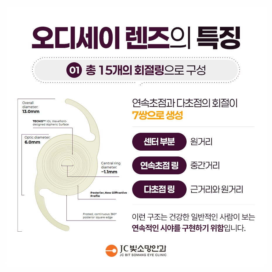 당뇨망막병증, 여의도망막 진료의 안내주사·레이저 단계별 치료 비교