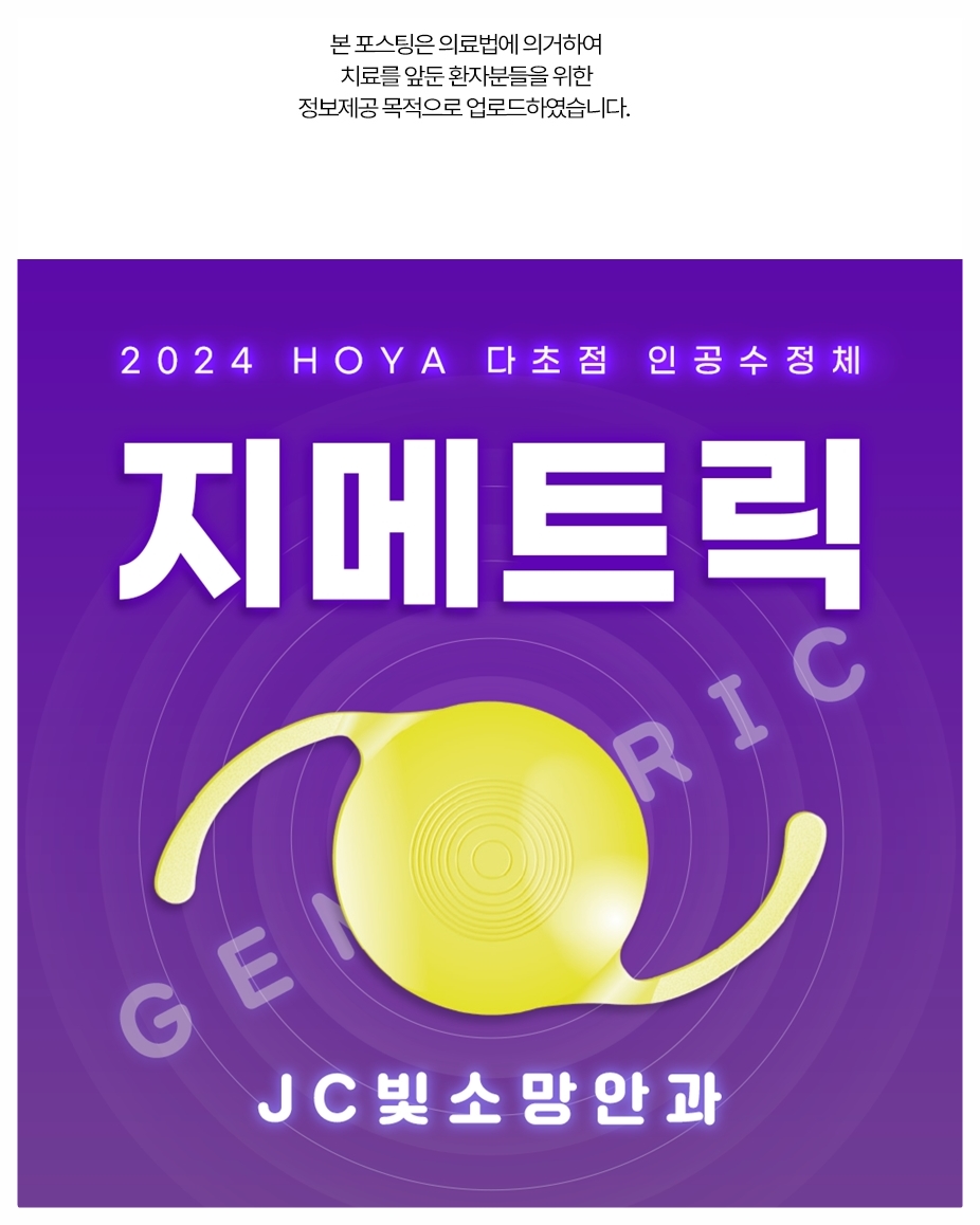 여의도라식 vs 스마일라식 절개 차이 — 각막 절편 유무와 회복 영향