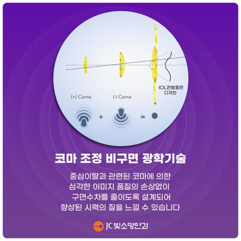 직선이 휘어 보이고 글자 가운데가 빈다면, 여의도망막 자가확인 후 진료 순서