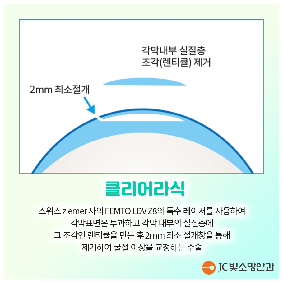 여의도 드림렌즈 vs 근시억제 안경렌즈, 우리 아이에게 더 맞는 건