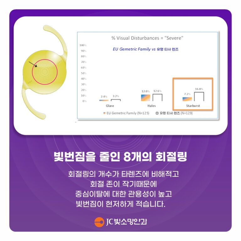 노안 백내장, 다초점·EDOF·단초점 인공수정체는 어떤 기준으로 선택하나요