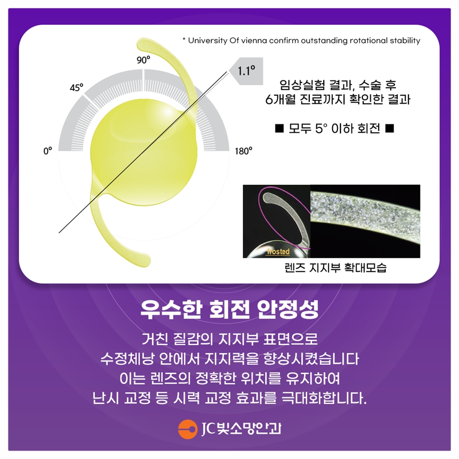 여의도라식 받기 전 알아야 할 각막두께 마지노선 기준