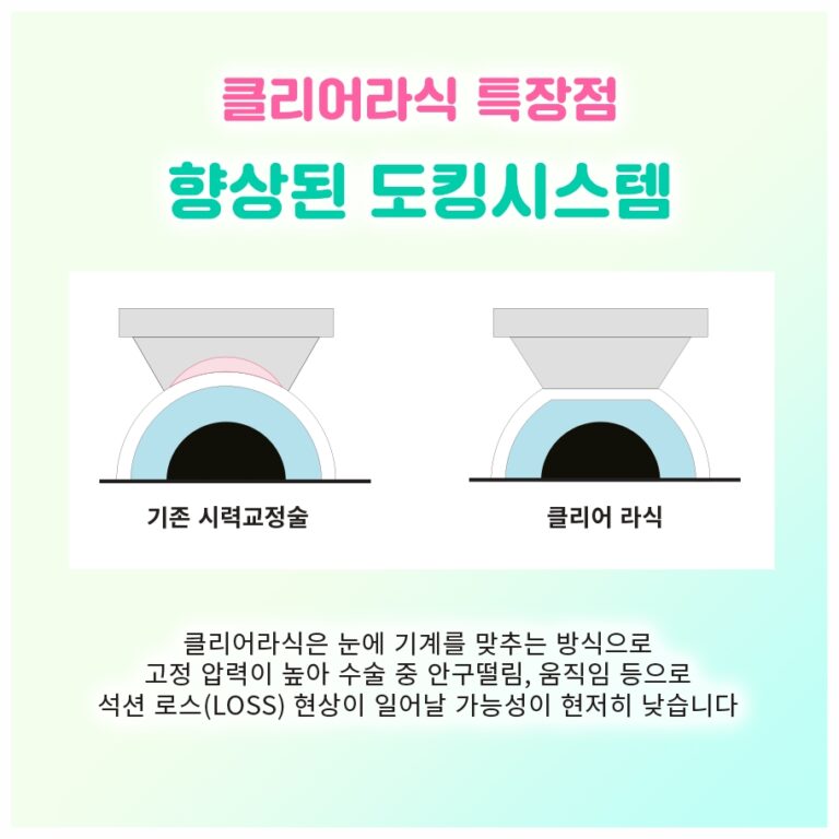 여의도안과검진 전 준비할 것과 검사 진행 과정 안내
