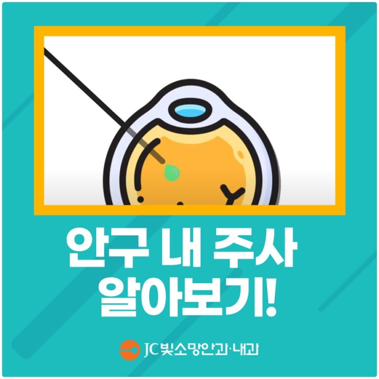 노안백내장 초기 신호, 건강검진 시력표가 놓치는 이유와 자가 확인법