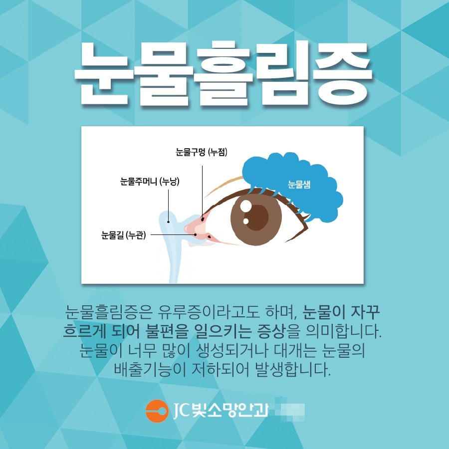 안구건조증에 대한 흔한 오해와 사실 - JC빛소망안과